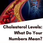 Cholesterol Levels