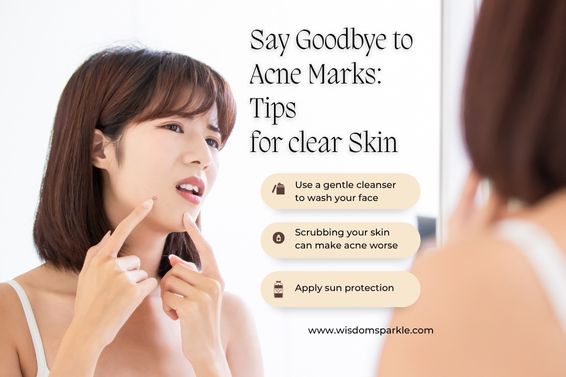 Acne Marks
