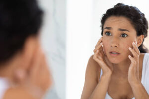 5 Skin Problems